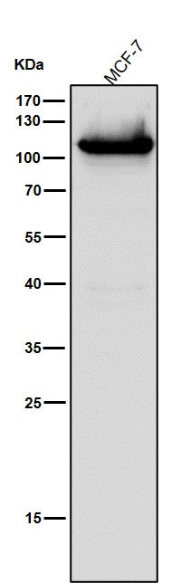 All lanes use the Antibody at 1:1k dilution for 1 hour at room temperature.