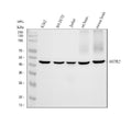 Anti-Somatostatin Receptor 2 SSTR2 Rabbit Monoclonal Antibody