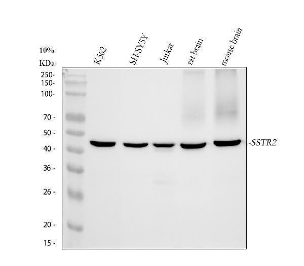 Anti-Somatostatin Receptor 2 SSTR2 Rabbit Monoclonal Antibody