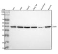 Anti-67kDa Laminin Receptor RPSA Rabbit Monoclonal Antibody