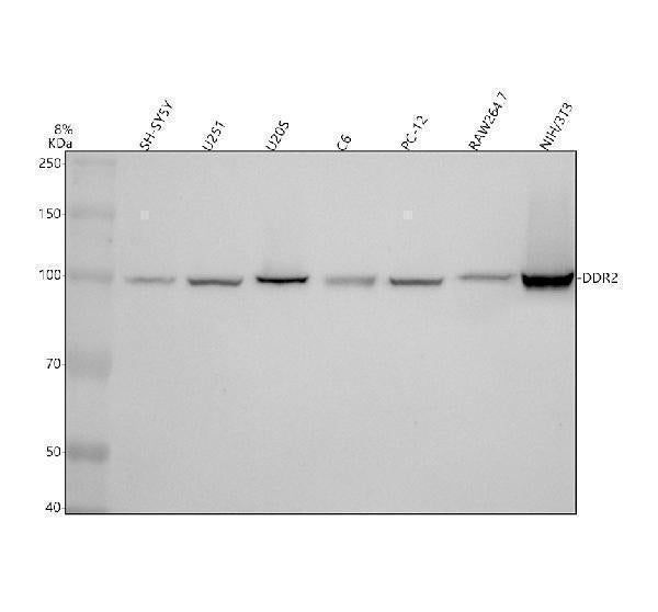 Anti-DDR2 Monoclonal Antibody