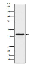 Western blot analysis of INDO expression in HeLa cell lysate treated with IFN gamma.