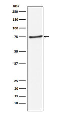 Western blot analysis of PIAS1 expression in Daudi cell lysate.
