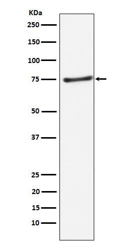 Western blot analysis of PIAS1 expression in Daudi cell lysate.