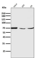 All lanes use the Antibody at 1:2K dilution for 1 hour at room temperature.