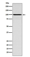 Western blot analysis of IFNGR1 expression in MCF7 cell lysate.
