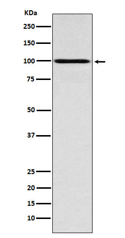 Western blot analysis of IFNGR1 expression in MCF7 cell lysate.