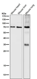 All lanes use the Antibody at 1:1W dilution for 1 hour at room temperature.