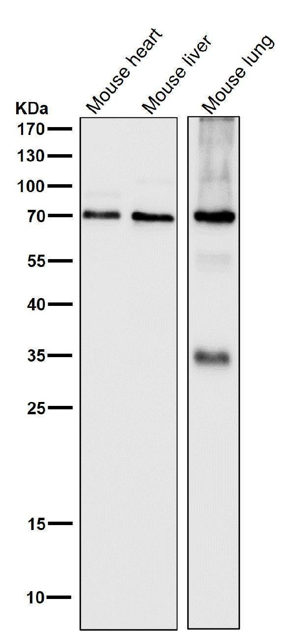 All lanes use the Antibody at 1:1W dilution for 1 hour at room temperature.