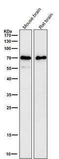 All lanes use the Antibody at 1:5K dilution for 1 hour at room temperature.