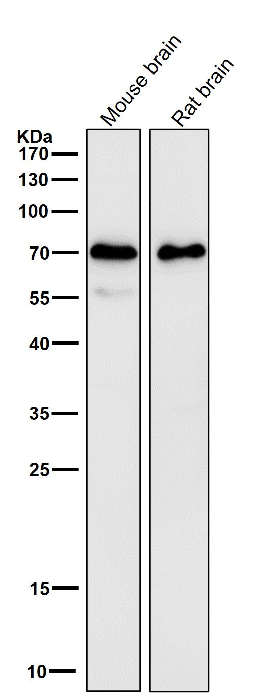 All lanes use the Antibody at 1:5K dilution for 1 hour at room temperature.