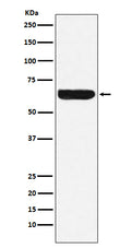Western blot analysis of Placental alkaline phosphatase (PLAP) expression in HeLa cell lysate.