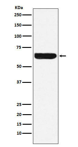 Western blot analysis of Placental alkaline phosphatase (PLAP) expression in HeLa cell lysate.