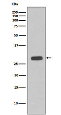 Western blot analysis of Troponin I expression in fetal heart cell lysate.