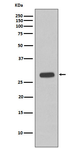 Western blot analysis of Troponin I expression in fetal heart cell lysate.