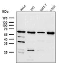 All lanes use the Antibody at 1:1K dilution for 1 hour at room temperature.