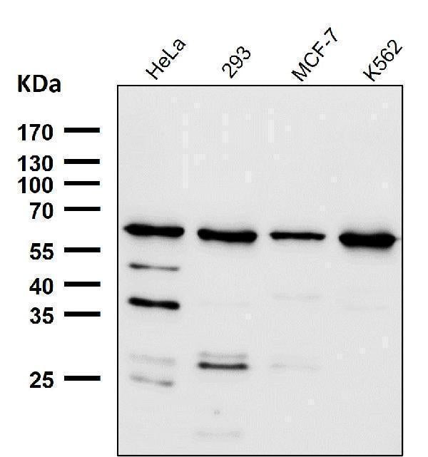 All lanes use the Antibody at 1:1K dilution for 1 hour at room temperature.