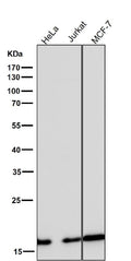 All lanes use the Antibody at 1:5K dilution for 1 hour at room temperature.