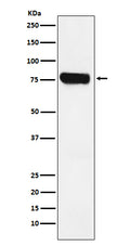 Western blot analysis of HEC1 expression in Jurkat cell lysate.