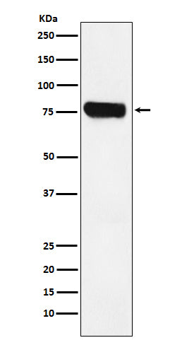 Western blot analysis of HEC1 expression in Jurkat cell lysate.