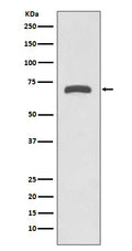 Western blot analysis of MMP8 expression in Human placenta lysate.