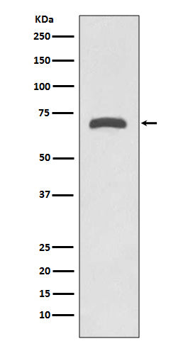 Western blot analysis of MMP8 expression in Human placenta lysate.