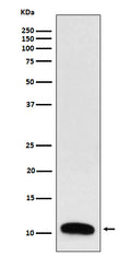 Western blot analysis of Trefoil Factor 3 expression in Human colon cancer lysate.