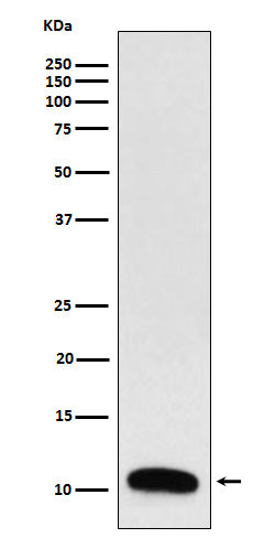 Western blot analysis of Trefoil Factor 3 expression in Human colon cancer lysate.