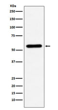 Western blot analysis of Liver Carboxylesterase 1 expression in U937 cell lysate.