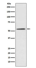 Western blot analysis of Protein C expression in HepG2 cell lysate.