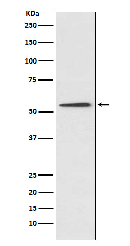 Western blot analysis of Protein C expression in HepG2 cell lysate.