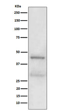 Western blot analysis of MBD2 expression in A431 cell lysate.