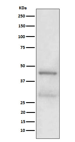 Western blot analysis of MBD2 expression in A431 cell lysate.