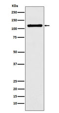 Western blot analysis of DPYD expression in HeLa cell lysate.