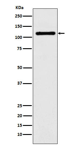 Western blot analysis of DPYD expression in HeLa cell lysate.