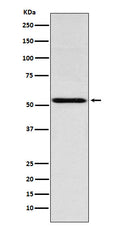 Western blot analysis of THRA expression in Jurkat cell lysate.