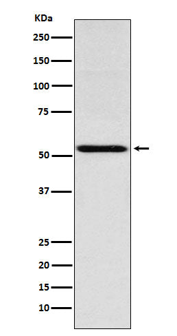 Western blot analysis of THRA expression in Jurkat cell lysate.