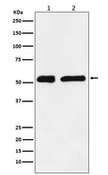Western blot analysis of KPNA2 expression in (1) HeLa cell lysate; (2) C6 cell lysate.