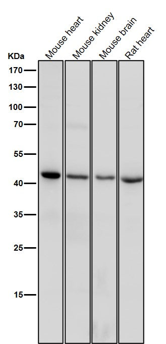 All lanes use the Antibody at 1:1K dilution for 1 hour at room temperature.