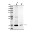 Anti-TGF alpha Monoclonal Antibody