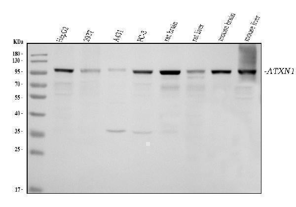 Anti-Ataxin 1 Antibody Picoband® (monoclonal, 2B13G8)