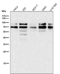 All lanes use the Antibody at 1:1K dilution for 1 hour at room temperature.