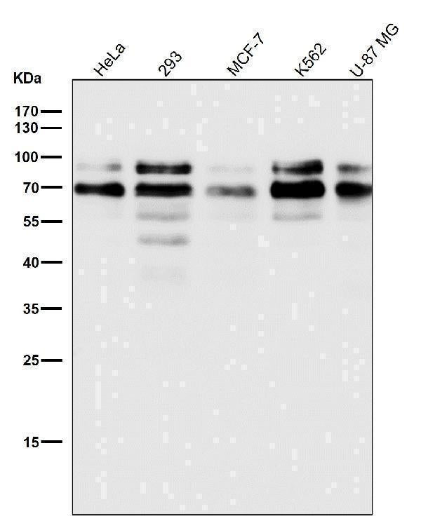 All lanes use the Antibody at 1:1K dilution for 1 hour at room temperature.