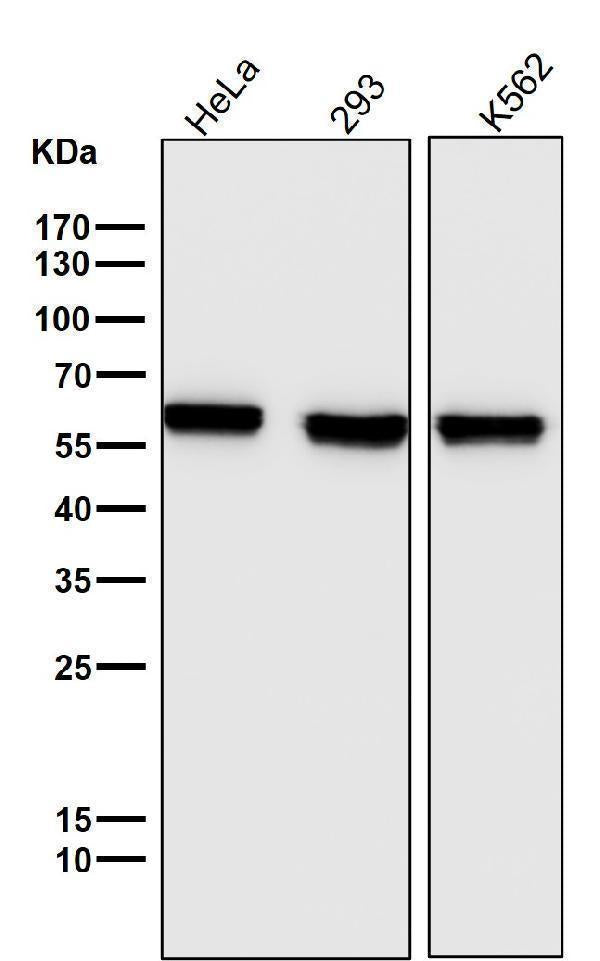 All lanes use the Antibody at 1:5K dilution for 1 hour at room temperature.