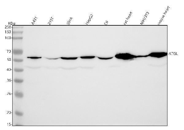 Anti-ATGL / PNPLA2 Rabbit Monoclonal Antibody