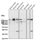 All lanes use the Antibody at 1:1K dilution for 1 hour at room temperature.