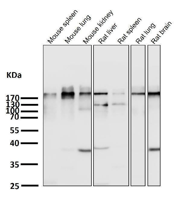 All lanes use the Antibody at 1:1K dilution for 1 hour at room temperature.