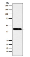 Western blot analysis of Cystathionase expression in HeLa cell lysate.