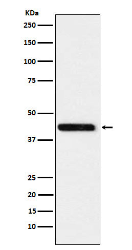 Western blot analysis of Cystathionase expression in HeLa cell lysate.