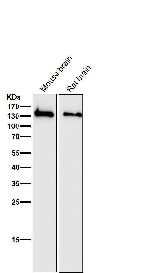 All lanes use the Antibody at 1:3K dilution for 1 hour at room temperature.